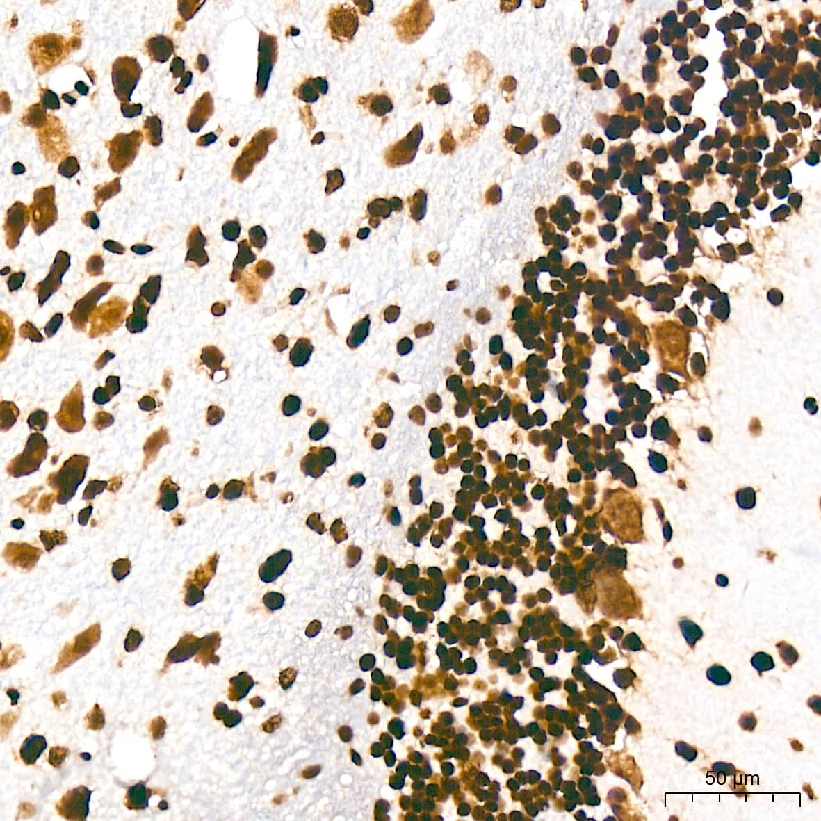 Immunohistochemistry: Histone H3 [ac Lys27] Antibody (2V10N10) [Histone H3] - Immunohistochemistry analysis of paraffin-embedded Mouse brain tissue using Histone H3 Rabbit mAb  at a dilution of 1:1000 (40x lens). High pressure antigen retrieval was performed with 0.01 M citrate buffer (pH 6.0) prior to IHC staining.