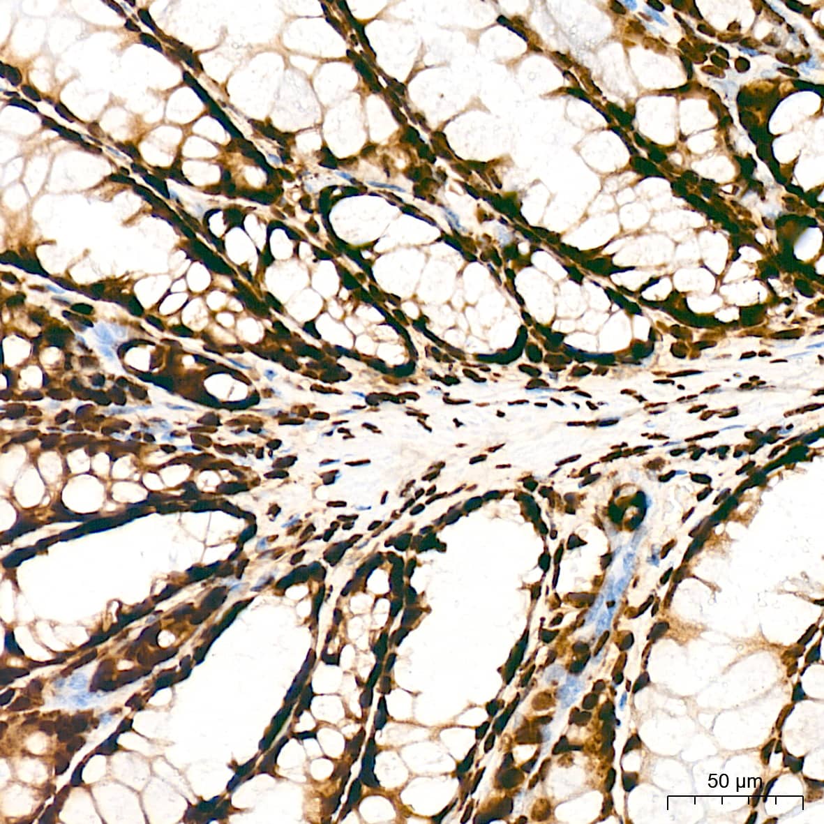 Immunohistochemistry: Histone H3 [ac Lys27] Antibody (2V10N10) [Histone H3] - Immunohistochemistry analysis of paraffin-embedded Mouse colon tissue using Histone H3 Rabbit mAb  at a dilution of 1:1000 (40x lens). High pressure antigen retrieval was performed with 0.01 M citrate buffer (pH 6.0) prior to IHC staining.