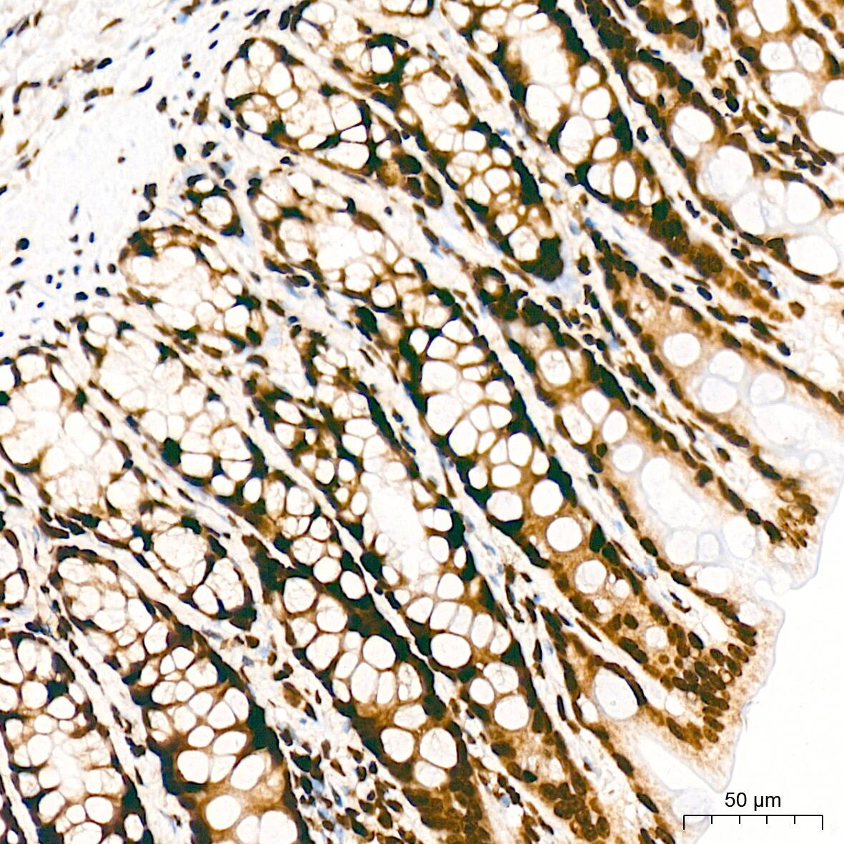 Immunohistochemistry: Histone H3 [ac Lys27] Antibody (2V10N10) [Histone H3] - Immunohistochemistry analysis of paraffin-embedded Rat colon tissue using Histone H3 Rabbit mAb  at a dilution of 1:1000 (40x lens). High pressure antigen retrieval was performed with 0.01 M citrate buffer (pH 6.0) prior to IHC staining.