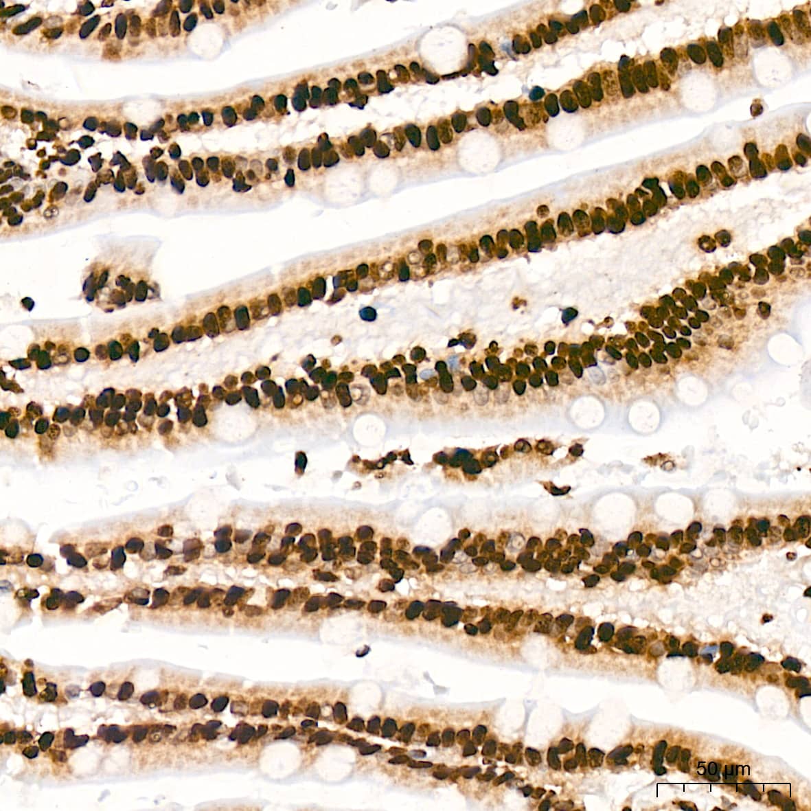 Immunohistochemistry: Histone H3 [ac Lys27] Antibody (2V10N10) [Histone H3] - Immunohistochemistry analysis of paraffin-embedded Human small intestine tissue using Histone H3 Rabbit mAb  at a dilution of 1:1000 (40x lens). High pressure antigen retrieval was performed with 0.01 M citrate buffer (pH 6.0) prior to IHC staining.