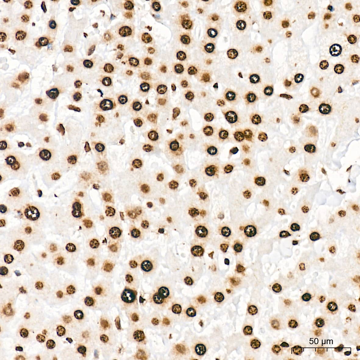 Immunohistochemistry: Histone H3 [ac Lys27] Antibody (2V10N10) [Histone H3] - Immunohistochemistry analysis of paraffin-embedded Human liver tissue using Histone H3 Rabbit mAb  at a dilution of 1:1000 (40x lens). High pressure antigen retrieval was performed with 0.01 M citrate buffer (pH 6.0) prior to IHC staining.
