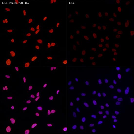 Immunocytochemistry/ Immunofluorescence: Histone H3 [ac Lys27] Antibody (2V10N10) [Histone H3] - Immunofluorescence analysis of HeLa treated with TSA and HeLa cells using Histone H3 Rabbit mAb  at dilution of 1:50 (40x lens). Secondary antibody: Cy3-conjugated Goat anti-Rabbit IgG (H+L)  at 1:500 dilution. Blue: DAPI for nuclear staining.