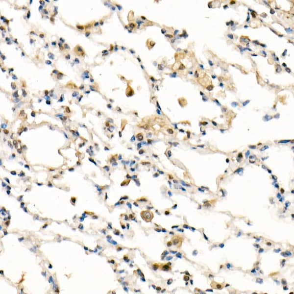 Immunohistochemistry: FADD Antibody (10L6M0) [FADD] - Immunohistochemistry analysis of paraffin-embedded rat lung using FADD Rabbit mAb  at dilution of 1:100 (40x lens).Perform high pressure antigen retrieval with 10 mM citrate buffer pH 6.0 before commencing with IHC staining protocol.