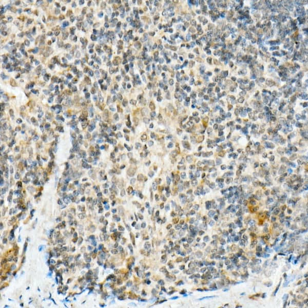 Immunohistochemistry: FADD Antibody (10L6M0) [FADD] - Immunohistochemistry analysis of paraffin-embedded mouse spleen using FADD Rabbit mAb  at dilution of 1:100 (40x lens).Perform high pressure antigen retrieval with 10 mM citrate buffer pH 6.0 before commencing with IHC staining protocol.