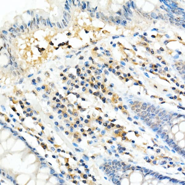 Immunohistochemistry: FADD Antibody (10L6M0) [FADD] - Immunohistochemistry analysis of paraffin-embedded human colon using FADD Rabbit mAb  at dilution of 1:100 (40x lens).Perform high pressure antigen retrieval with 10 mM citrate buffer pH 6.0 before commencing with IHC staining protocol.