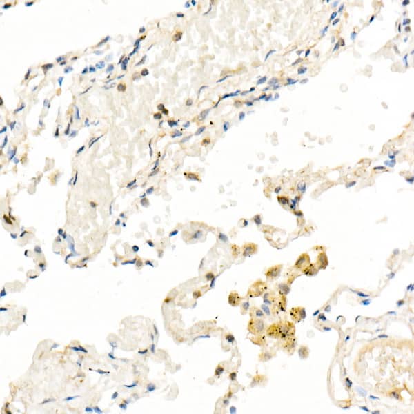 Immunohistochemistry: FADD Antibody (10L6M0) [FADD] - Immunohistochemistry analysis of paraffin-embedded human lung using FADD Rabbit mAb  at dilution of 1:100 (40x lens).Perform high pressure antigen retrieval with 10 mM citrate buffer pH 6.0 before commencing with IHC staining protocol.