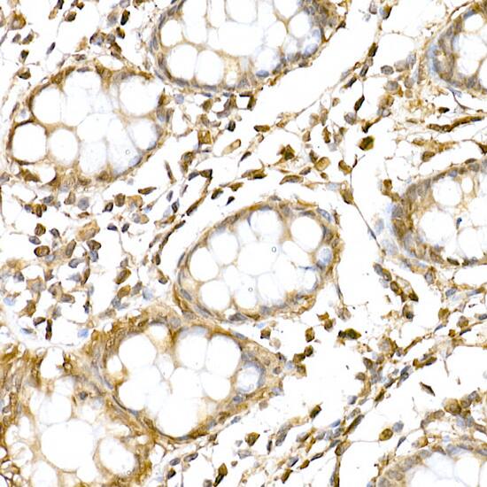 Immunohistochemistry: RNF126 Antibody - Azide and BSA Free [RNF126] - Immunohistochemistry analysis of paraffin-embedded human colon using RNF126 Rabbit pAb  at dilution of 1:250 (40x lens).Perform high pressure antigen retrieval with 10 mM citrate buffer pH 6.0 before commencing with IHC staining protocol.