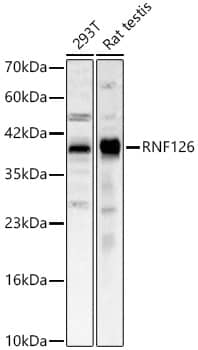Western Blot: RNF126 Antibody - Azide and BSA Free [RNF126] - Western blot analysis of various lysates, using RNF126 Rabbit pAb  at 1:2000 dilution.Secondary antibody: HRP Goat Anti-Rabbit IgG (H+L)  at 1:10000 dilution.Lysates/proteins: 25ug per lane.Blocking buffer: 3% nonfat dry milk in TBST.Detection: ECL Basic Kit .Exposure time: 30s.