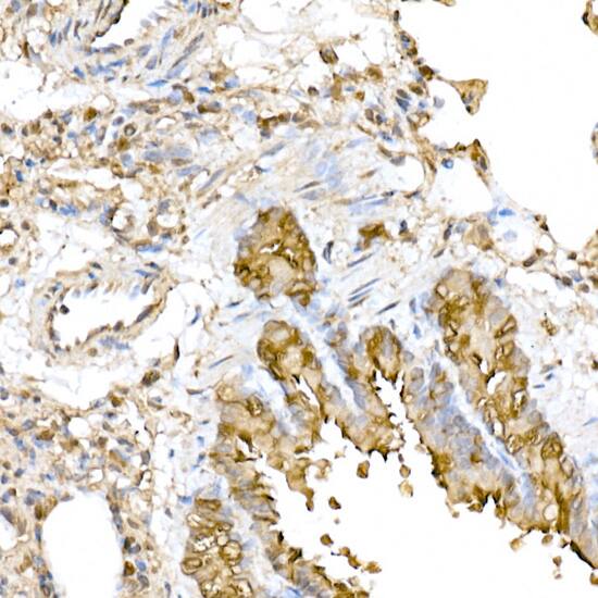 Immunohistochemistry: RNF126 Antibody - Azide and BSA Free [RNF126] - Immunohistochemistry analysis of paraffin-embedded rat lung using RNF126 Rabbit pAb  at dilution of 1:250 (40x lens).Perform high pressure antigen retrieval with 10 mM citrate buffer pH 6.0 before commencing with IHC staining protocol.