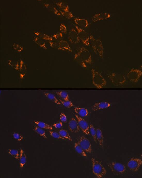 Immunocytochemistry/ Immunofluorescence: RNF126 Antibody - Azide and BSA Free [RNF126] - Immunofluorescence analysis of NIH-3T3 cells using RNF126 Rabbit pAb  at dilution of 1:100 (40x lens). Secondary antibody: Cy3 Goat Anti-Rabbit IgG (H+L)  at 1:500 dilution. Blue: DAPI for nuclear staining.