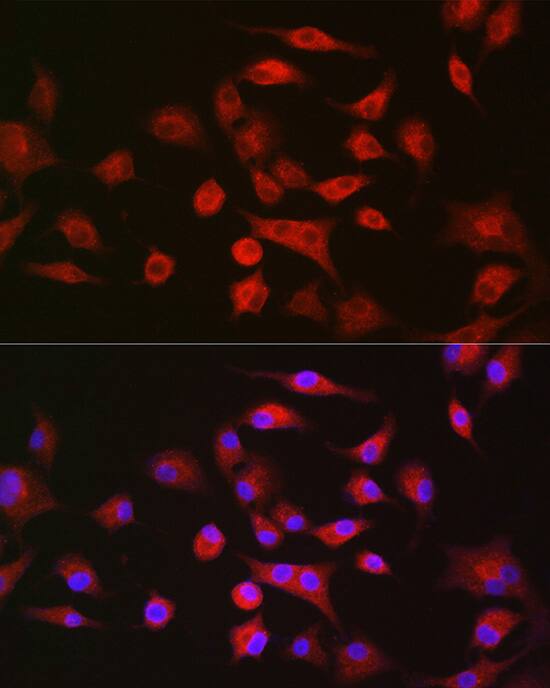 Immunocytochemistry/ Immunofluorescence: Lgl1 Antibody - Azide and BSA Free [Lgl1] - Immunofluorescence analysis of A-549 cells using Lgl1 Rabbit pAb  at dilution of 1:100. Secondary antibody: Cy3 Goat Anti-Rabbit IgG (H+L)  at 1:500 dilution. Blue: DAPI for nuclear staining.