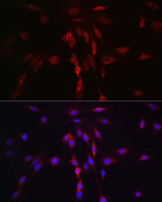 Immunocytochemistry/ Immunofluorescence: Lgl1 Antibody - Azide and BSA Free [Lgl1] - Immunofluorescence analysis of C6 cells using Lgl1 Rabbit pAb  at dilution of 1:100. Secondary antibody: Cy3 Goat Anti-Rabbit IgG (H+L)  at 1:500 dilution. Blue: DAPI for nuclear staining.