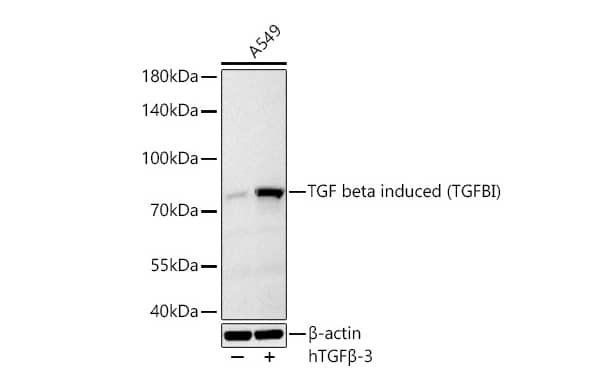 Analysis of lysates from A549 cells using TGF beta induced (TGFBI) Rabbit mAb at 1:1000 dilution incubated overnight at 4℃. A549 treated with hTGF beta -3 (100 ng/ml) at 37℃ for 16 hours.Secondary antibody: HRP-conjugated Goat anti-Rabbit IgG (H+L) at 1:10000 dilution.Lysates/proteins: 30 μg per lane.Blocking buffer: 3 % nonfat dry milk in TBST.Detection: ECL Basic Kit. Exposure time: 45 s.