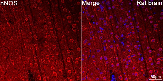 Immunocytochemistry/ Immunofluorescence: nNOS Antibody (5K9R2) [nNOS] - Confocal imaging of paraffin-embedded Rat brain using nNOS Rabbit mAb  followed by a further incubation with Cy3 Goat Anti-Rabbit IgG (H+L)  . DAPI was used for nuclear staining (Blue). Objective: 40x. Perform microwave antigen retrieval with 0.01 M citrate buffer (pH 6.0) prior to IF staining.