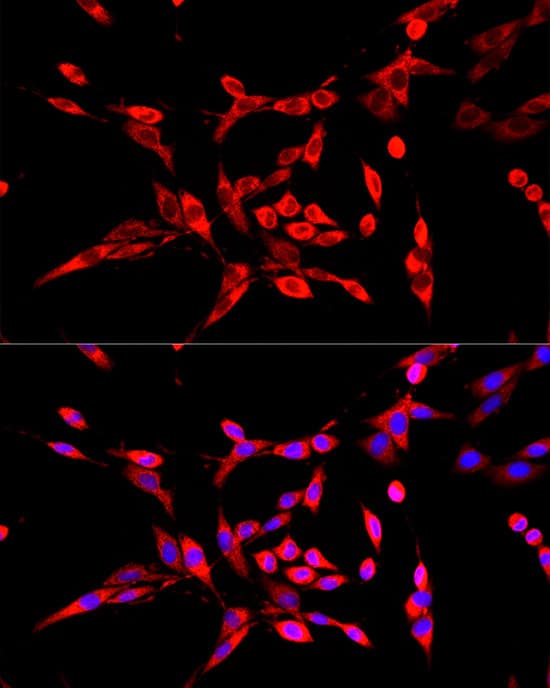 Immunocytochemistry/ Immunofluorescence: DBT Antibody - Azide and BSA Free [DBT] - Immunofluorescence analysis of PC-12 cells using DBT Rabbit pAb  at dilution of 1:100 (40x lens). Secondary antibody: Cy3 Goat Anti-Rabbit IgG (H+L)  at 1:500 dilution. Blue: DAPI for nuclear staining.