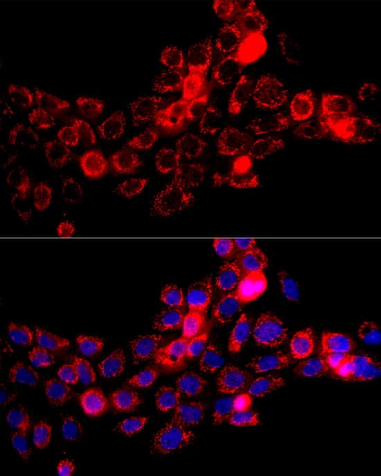 Immunocytochemistry/ Immunofluorescence: DBT Antibody - Azide and BSA Free [DBT] - Immunofluorescence analysis of A-431 cells using DBT Rabbit pAb  at dilution of 1:100 (40x lens). Secondary antibody: Cy3 Goat Anti-Rabbit IgG (H+L)  at 1:500 dilution. Blue: DAPI for nuclear staining.