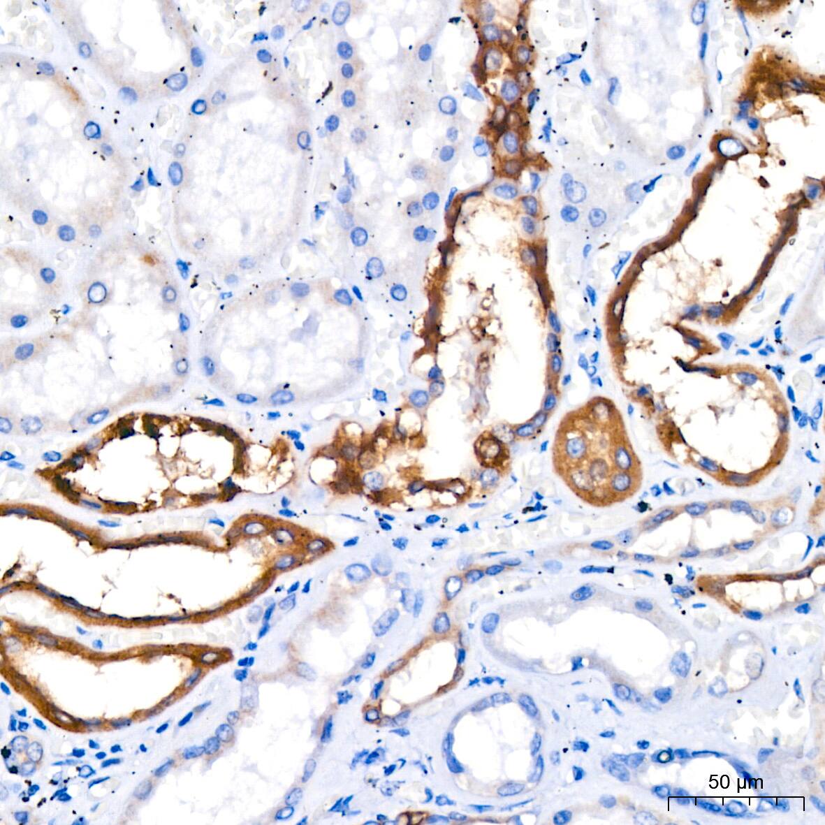 Immunohistochemistry: FACL4 Antibody (4W3T9) [FACL4] - Immunohistochemistry analysis of paraffin-embedded Human kidney using FACL4 Rabbit mAb  at dilution of 1:200 (40x lens). High pressure antigen retrieval performed with 0.01M Citrate Bufferr (pH 6.0) prior to IHC staining.