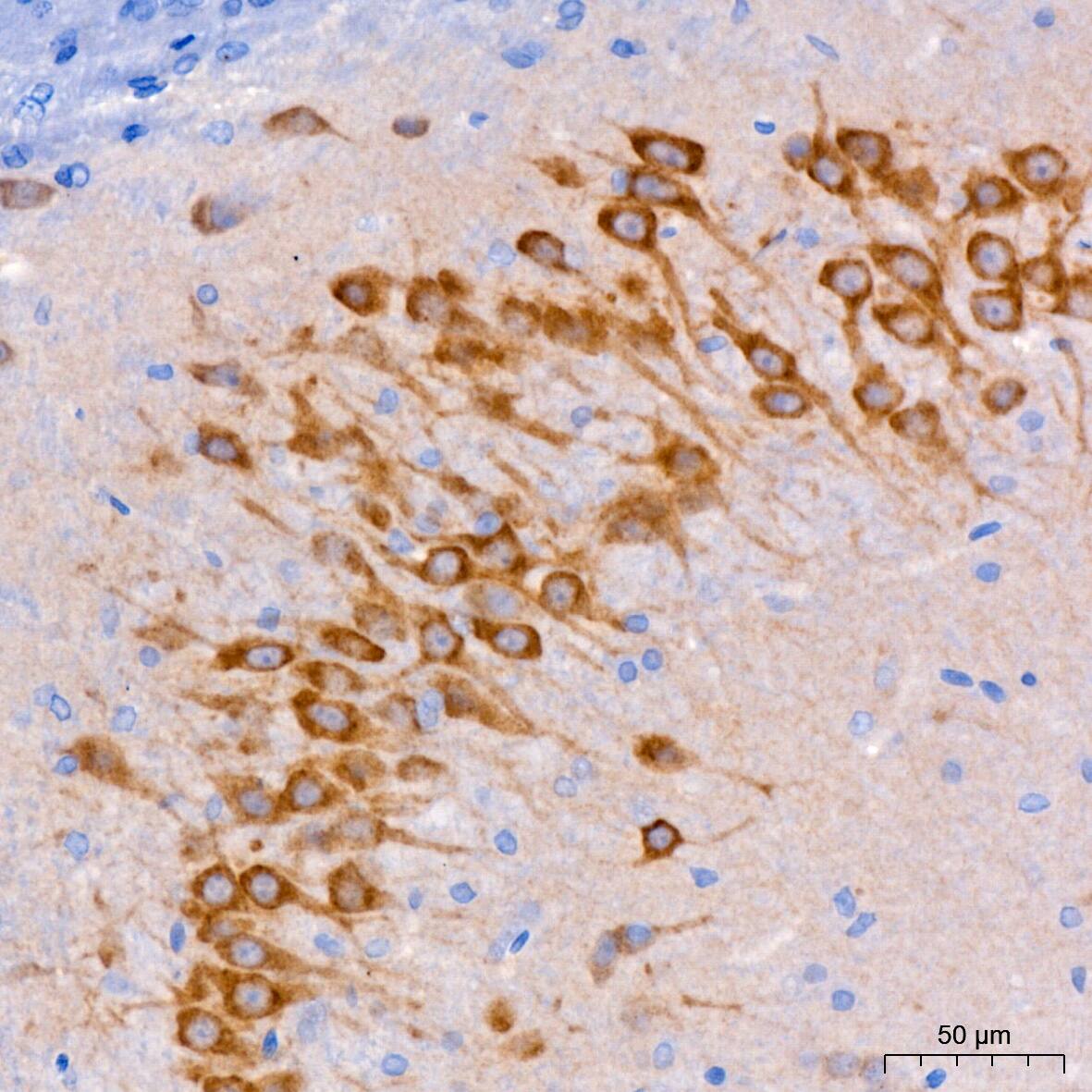 Immunohistochemistry: FACL4 Antibody (4W3T9) [FACL4] - Immunohistochemistry analysis of paraffin-embedded Rat brain using FACL4 Rabbit mAb  at dilution of 1:200 (40x lens). High pressure antigen retrieval performed with 0.01M Citrate Bufferr (pH 6.0) prior to IHC staining.