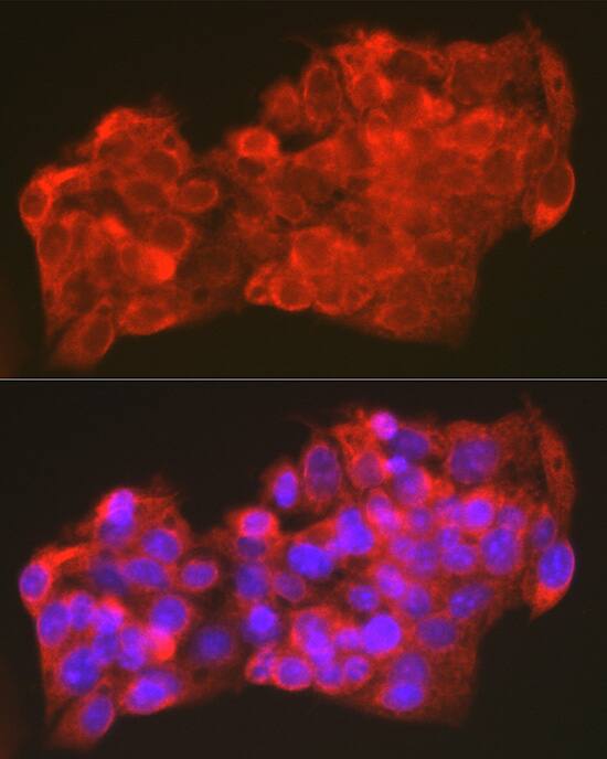 Immunocytochemistry/ Immunofluorescence: OXPAT Antibody - Azide and BSA Free [NBP3-16013] - Immunofluorescence analysis of HepG2 cells using OXPAT Rabbit pAb  at dilution of 1:100 (40x lens). Secondary antibody: Cy3 Goat Anti-Rabbit IgG (H+L)  at 1:500 dilution. Blue: DAPI for nuclear staining.