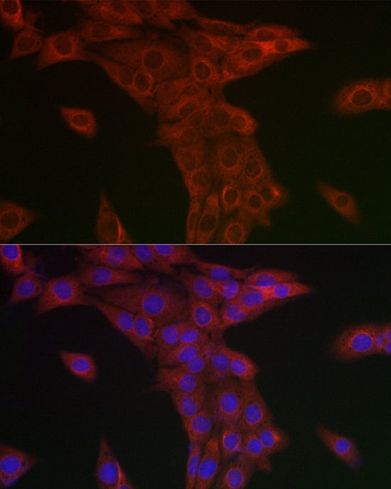 Immunocytochemistry/ Immunofluorescence: Syntrophin alpha 1 Antibody - Azide and BSA Free [Syntrophin alpha 1] - Immunofluorescence analysis of PC-12 cells using Syntrophin alpha 1 Rabbit pAb  at dilution of 1:50 (40x lens). Secondary antibody: Cy3-conjugated Goat anti-Rabbit IgG (H+L)  at 1:500 dilution. Blue: DAPI for nuclear staining.
