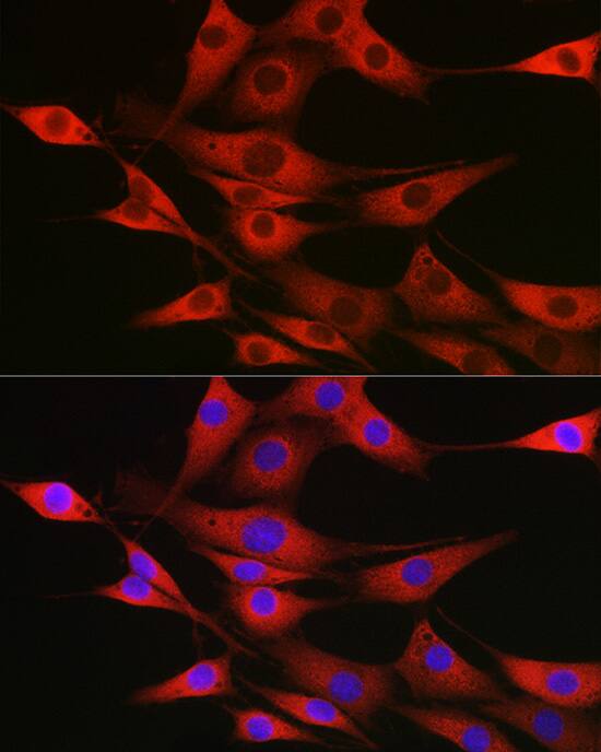 Immunocytochemistry/ Immunofluorescence: SSR2 Antibody - Azide and BSA Free [SSR2] - Immunofluorescence analysis of NIH/3T3 cells using SSR2 Rabbit pAb  at dilution of 1:100 (40x lens). Secondary antibody: Cy3 Goat Anti-Rabbit IgG (H+L)  at 1:500 dilution. Blue: DAPI for nuclear staining.
