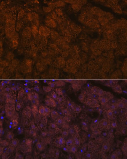 Immunocytochemistry/ Immunofluorescence: ADAMTS13 Antibody (7B2Z8) [ADAMTS13] - Immunofluorescence analysis of paraffin-embedded human liver using ADAMTS13 Rabbit mAb  at dilution of 1:100 (40x lens). Secondary antibody: Cy3 Goat Anti-Rabbit IgG (H+L)  at 1:500 dilution. Blue: DAPI for nuclear staining.