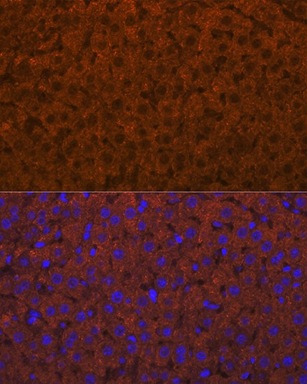 Immunocytochemistry/ Immunofluorescence: ADAMTS13 Antibody (7B2Z8) [ADAMTS13] - Immunofluorescence analysis of paraffin-embedded rat liver using ADAMTS13 Rabbit mAb  at dilution of 1:100 (40x lens). Secondary antibody: Cy3 Goat Anti-Rabbit IgG (H+L)  at 1:500 dilution. Blue: DAPI for nuclear staining.