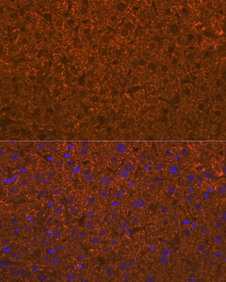 Immunocytochemistry/ Immunofluorescence: ADAMTS13 Antibody (7B2Z8) [ADAMTS13] - Immunofluorescence analysis of paraffin-embedded mouse liver using ADAMTS13 Rabbit mAb  at dilution of 1:100 (40x lens). Secondary antibody: Cy3 Goat Anti-Rabbit IgG (H+L)  at 1:500 dilution. Blue: DAPI for nuclear staining.