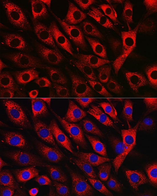Immunocytochemistry/ Immunofluorescence: UFL1 Antibody - Azide and BSA Free [UFL1] - Immunofluorescence analysis of NIH/3T3 cells using UFL1 Rabbit pAb  at dilution of 1:50 (40x lens). Secondary antibody: Cy3-conjugated Goat anti-Rabbit IgG (H+L)  at 1:500 dilution. Blue: DAPI for nuclear staining.