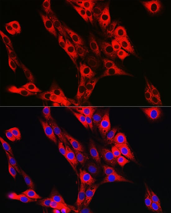 Immunocytochemistry/ Immunofluorescence: UFL1 Antibody - Azide and BSA Free [UFL1] - Immunofluorescence analysis of PC-12 cells using UFL1 Rabbit pAb  at dilution of 1:50 (40x lens). Secondary antibody: Cy3-conjugated Goat anti-Rabbit IgG (H+L)  at 1:500 dilution. Blue: DAPI for nuclear staining.