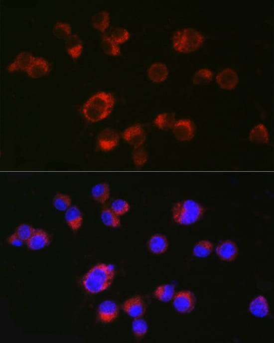 Immunocytochemistry/ Immunofluorescence: 5-HT2A Antibody - Azide and BSA Free [5-HT2A] - Immunofluorescence analysis of Neuro-2a cells using 5-HT2A Rabbit pAb  at dilution of 1:50 (40x lens). Secondary antibody: Cy3-conjugated Goat anti-Rabbit IgG (H+L)  at 1:500 dilution. Blue: DAPI for nuclear staining.