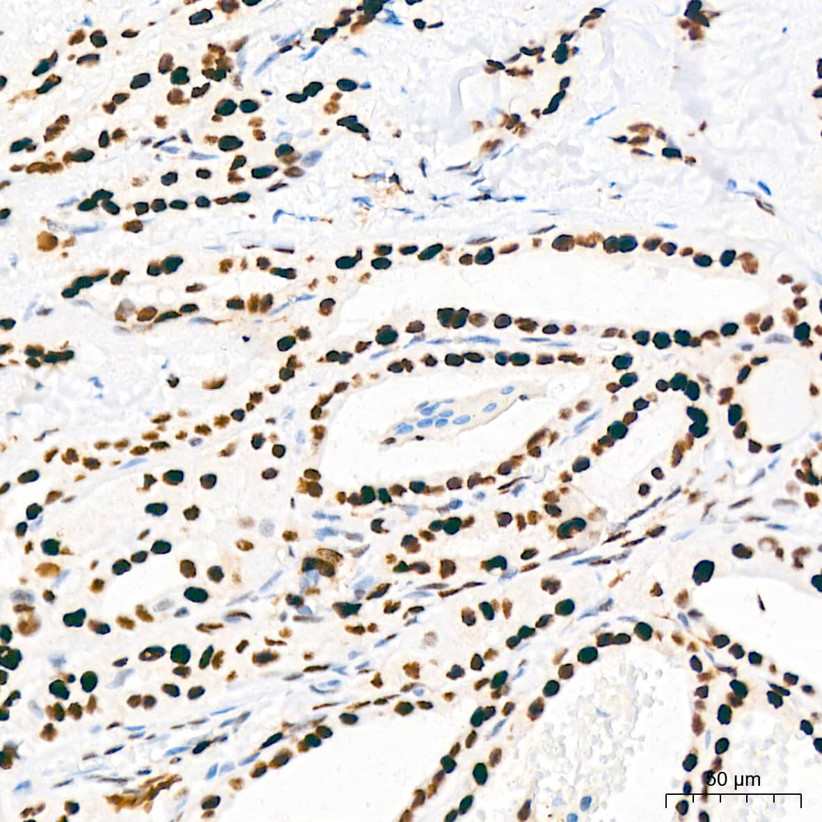 Immunohistochemistry: MCM2 Antibody (0Q10S9) [NBP3-16066] - Immunohistochemistry analysis of paraffin-embedded Human thyroid tissue using MCM2 Rabbit mAb at a dilution of 1:200 (40x lens). High pressure antigen retrieval performed with 0.01M Citrate Bufferr (pH 6.0) prior to IHC staining.