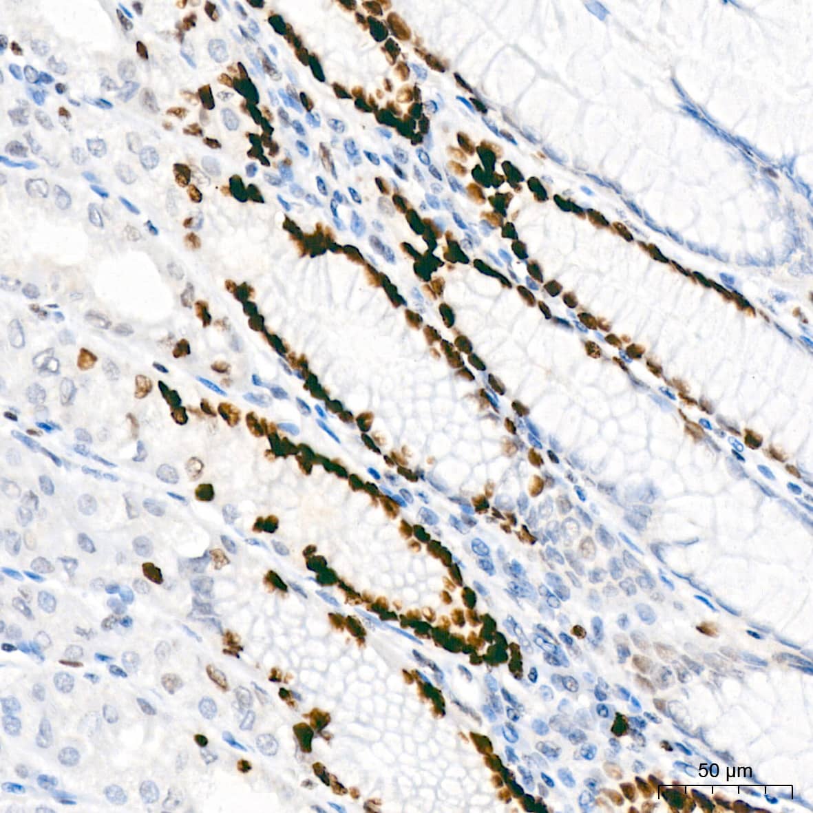 Immunohistochemistry: MCM2 Antibody (0Q10S9) [NBP3-16066] - Immunohistochemistry analysis of paraffin-embedded Human stomach tissue using MCM2 Rabbit mAb at a dilution of 1:200 (40x lens). High pressure antigen retrieval performed with 0.01M Citrate Bufferr (pH 6.0) prior to IHC staining.