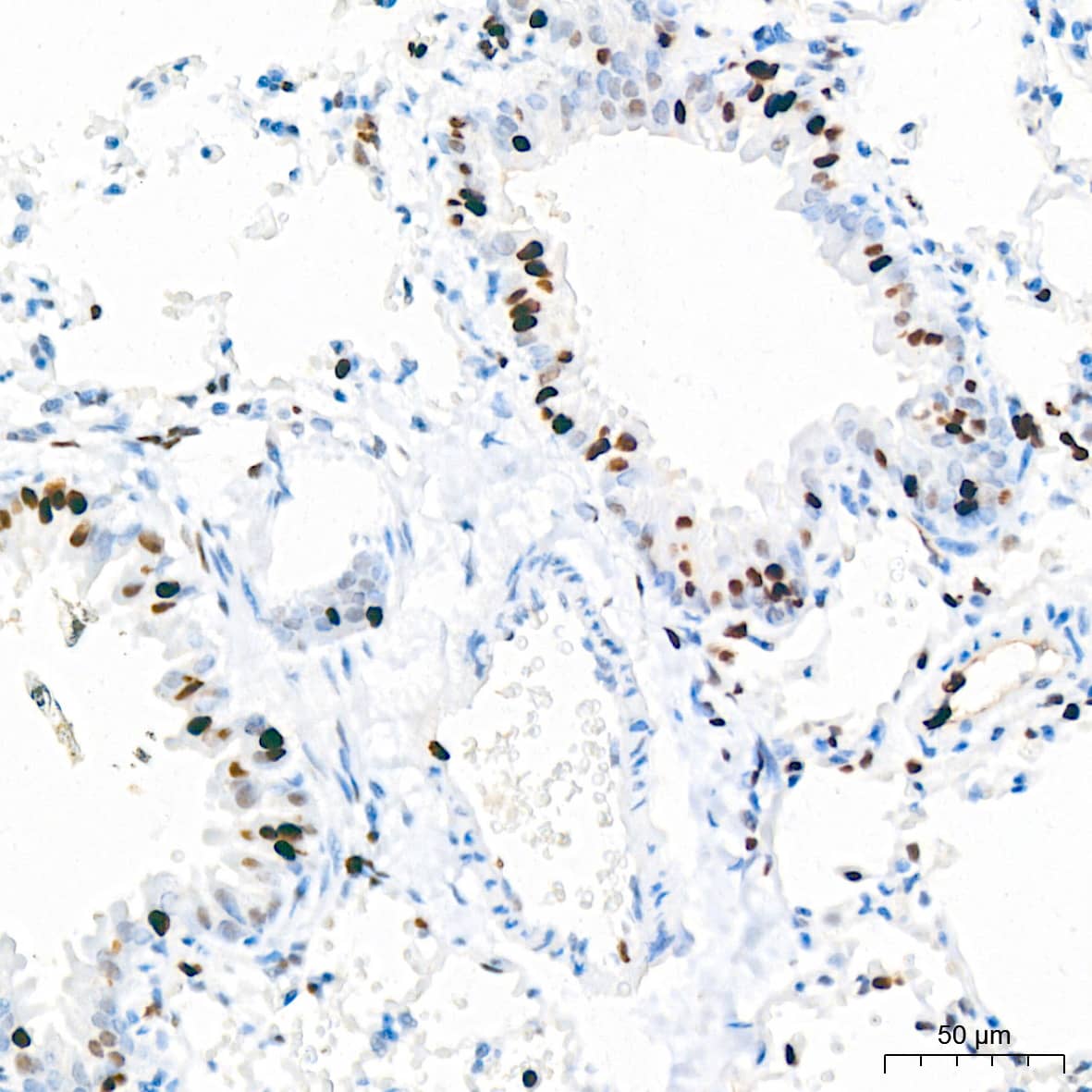 Immunohistochemistry: MCM2 Antibody (0Q10S9) [NBP3-16066] - Immunohistochemistry analysis of paraffin-embedded Mouse lung tissue using MCM2 Rabbit mAb at a dilution of 1:200 (40x lens). High pressure antigen retrieval performed with 0.01M Citrate Bufferr (pH 6.0) prior to IHC staining.