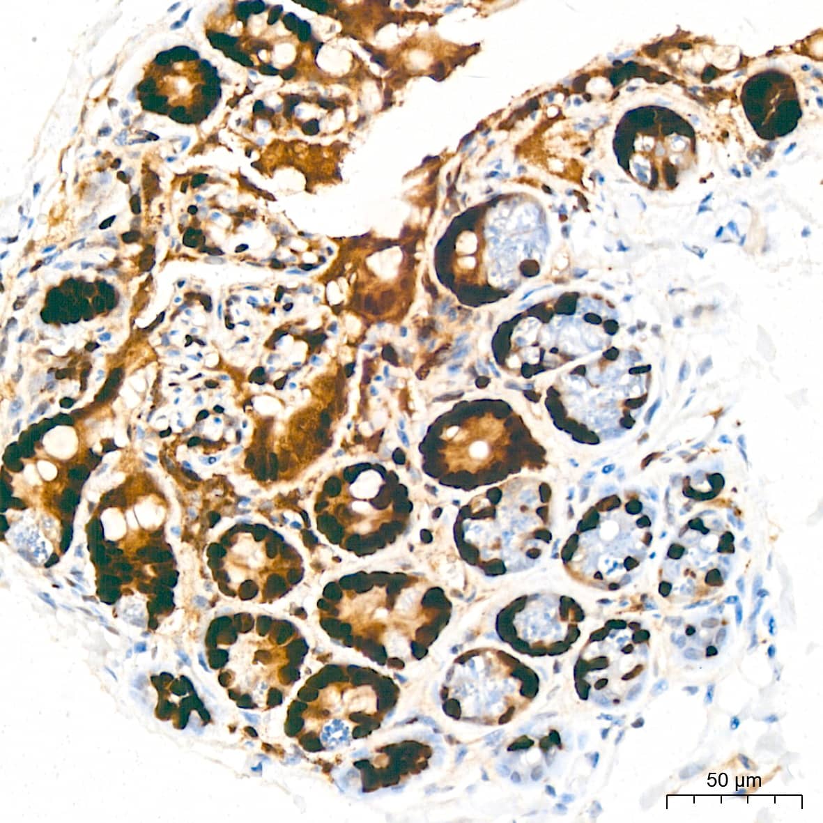 Immunohistochemistry: MCM2 Antibody (0Q10S9) [NBP3-16066] - Immunohistochemistry analysis of paraffin-embedded Mouse colon tissue using MCM2 Rabbit mAb at a dilution of 1:200 (40x lens). High pressure antigen retrieval performed with 0.01M Citrate Bufferr (pH 6.0) prior to IHC staining.