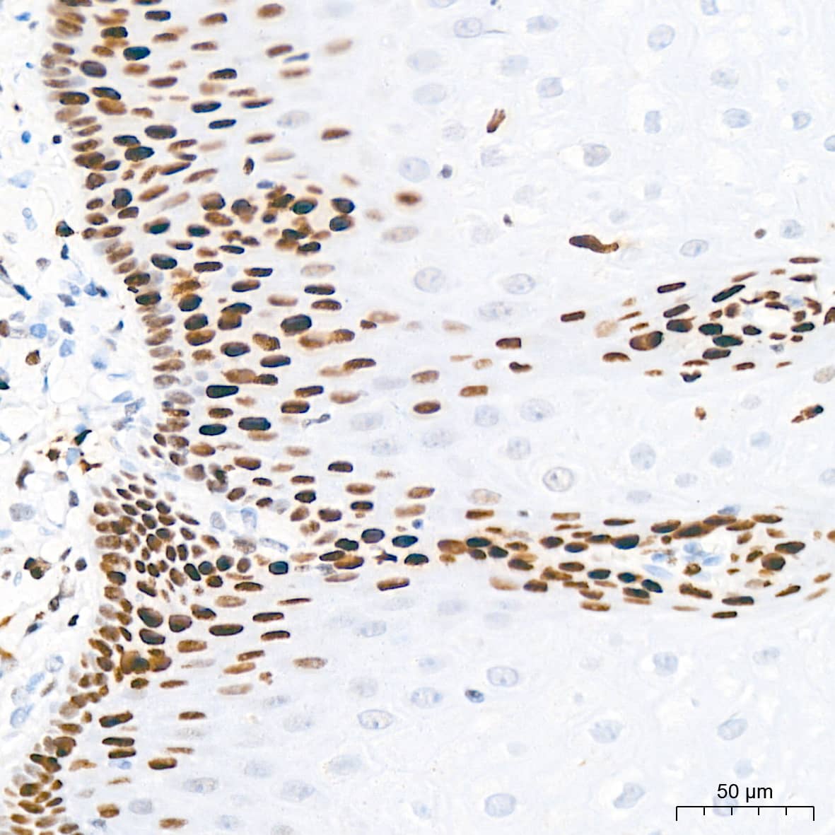 Immunohistochemistry: MCM2 Antibody (0Q10S9) [NBP3-16066] - Immunohistochemistry analysis of paraffin-embedded Human esophagus tissue using MCM2 Rabbit mAb at a dilution of 1:200 (40x lens). High pressure antigen retrieval performed with 0.01M Citrate Bufferr (pH 6.0) prior to IHC staining.