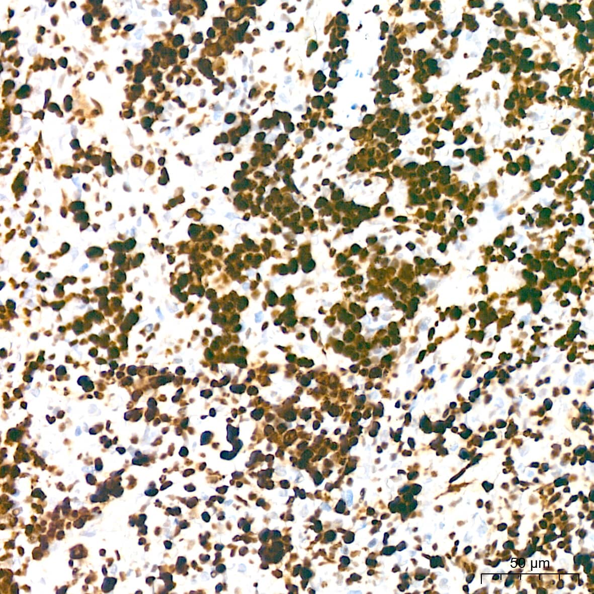 Immunohistochemistry: MCM2 Antibody (0Q10S9) [NBP3-16066] - Immunohistochemistry analysis of paraffin-embedded Rat spleen tissue using MCM2 Rabbit mAb at a dilution of 1:200 (40x lens). High pressure antigen retrieval performed with 0.01M Citrate Bufferr (pH 6.0) prior to IHC staining.