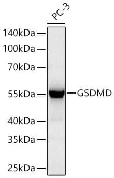 Western Blot: GSDMDC1 Antibody (5U7R7) [NBP3-16070] - Western blot analysis of lysates from PC-3 cells using GSDMDC1 Rabbit mAb at 1:1000 dilution incubated overnight at 4C.Secondary antibody: HRP-conjugated Goat anti-Rabbit IgG (H+L) at 1:10000 dilution.Lysates/proteins: 25 ug per lane.Blocking buffer: 3% nonfat dry milk in TBST.Detection: ECL Basic Kit.Exposure time: 45s.