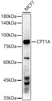 Western Blot: CPT1A Antibody (3M6E9) [NBP3-16072] - Western blot analysis of lysates from MCF7 cells, using CPT1A Rabbit mAb at 1:1000 dilution.Secondary antibody: HRP-conjugated Goat anti-Rabbit IgG (H+L) at 1:10000 dilution.Lysates/proteins: 25ug per lane.Blocking buffer: 3% nonfat dry milk in TBST.Detection: ECL Enhanced Kit.Exposure time: 180s.