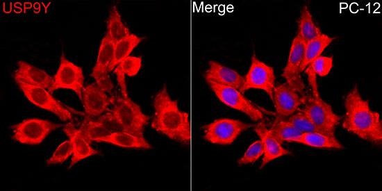 Immunocytochemistry/ Immunofluorescence: USP9Y Antibody - Azide and BSA Free [NBP3-16073] - Immunofluorescence analysis of PC-12 cells using USP9Y Rabbit pAb  at dilution of 1:100 (40x lens). Secondary antibody: Cy3 Goat Anti-Rabbit IgG (H+L)  at 1:500 dilution. Blue: DAPI for nuclear staining.