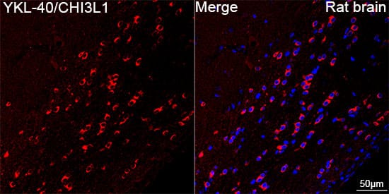 Immunocytochemistry/ Immunofluorescence: Chitinase 3-like 1/YKL-40 Antibody (7T1R3) [NBP3-16077] - Confocal imaging of paraffin-embedded Rat brain tissue using Chitinase 3-like 1/YKL-40 Rabbit mAb followed by a further incubation with Cy3 Goat Anti-Rabbit IgG (H+L) . DAPI was used for nuclear staining (Blue). Objective: 40x. Perform microwave antigen retrieval with 0.01 M citrate buffer (pH 6.0) prior to IF staining.