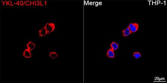 Immunocytochemistry/ Immunofluorescence: Chitinase 3-like 1/YKL-40 Antibody (7T1R3) [NBP3-16077] - Confocal imaging of THP-1 cells using Chitinase 3-like 1/YKL-40 Rabbit mAb followed by a further incubation with Cy3 Goat Anti-Rabbit IgG (H+L) . DAPI was used for nuclear staining (Blue). Objective: 100x.