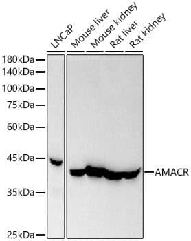 Western Blot: alpha-Methylacyl-CoA Racemase/AMACR Antibody (4R3L10) [NBP3-16091] - Analysis of various lysates, using AMACR antibody at 1:2000 dilution.Secondary antibody: HRP Goat Anti-Rabbit IgG (H+L) at 1:10000 dilution.Lysates/proteins: 25ug per lane.Blocking buffer: 3% nonfat dry milk in TBST.Detection: ECL Basic Kit.  Exposure time: 10s.