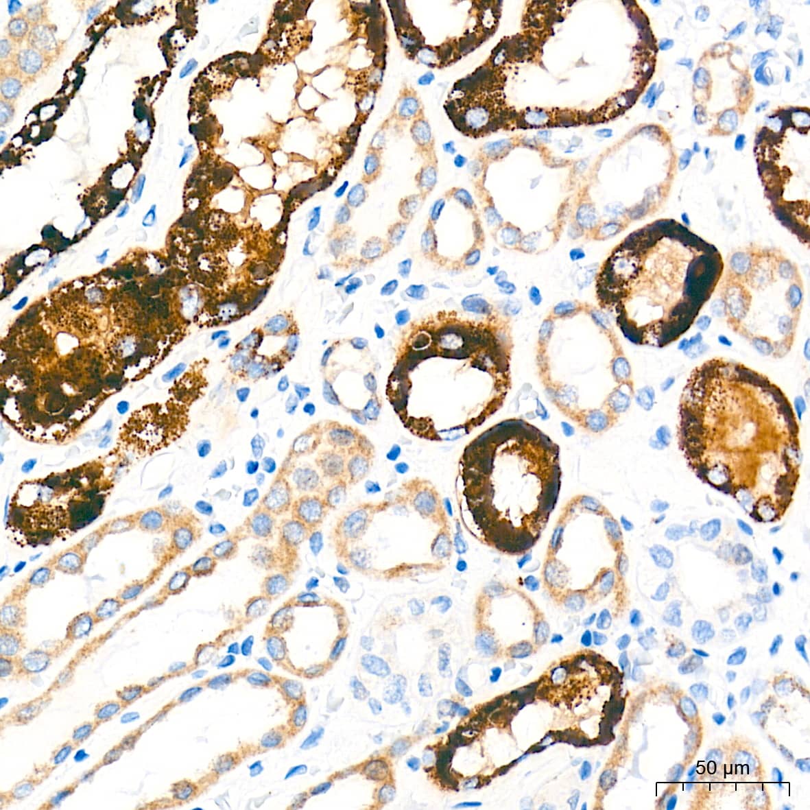 Immunohistochemistry: alpha-Methylacyl-CoA Racemase/AMACR Antibody (7X5Z2) [NBP3-16091] - Immunohistochemistry analysis of paraffin-embedded Human kidney tissue using alpha-Methylacyl-CoA Racemase/AMACR Rabbit mAb at a dilution of 1:2000 (40x lens). High pressure antigen retrieval performed with 0.01M Tris-EDTA Buffer (pH 9.0) prior to IHC staining.