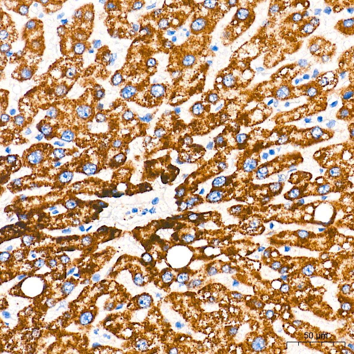 Immunohistochemistry: alpha-Methylacyl-CoA Racemase/AMACR Antibody (7X5Z2) [NBP3-16091] - Immunohistochemistry analysis of paraffin-embedded Human liver tissue using alpha-Methylacyl-CoA Racemase/AMACR Rabbit mAb at a dilution of 1:2000 (40x lens). High pressure antigen retrieval performed with 0.01M Tris-EDTA Buffer (pH 9.0) prior to IHC staining.