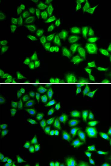 Immunocytochemistry/ Immunofluorescence: Cullin 1 Antibody - Azide and BSA Free [NBP3-16092] - Immunofluorescence analysis of HeLa cells using Cullin 1 Rabbit pAb . Secondary antibody: Cy3-conjugated Goat anti-Rabbit IgG (H+L) at 1:500 dilution. Blue: DAPI for nuclear staining.