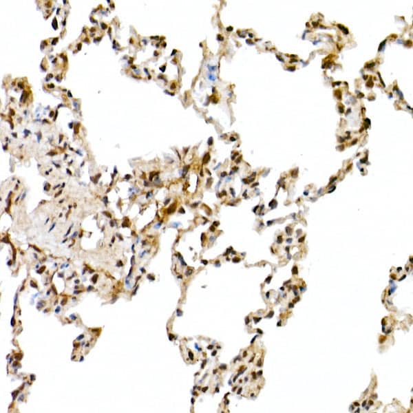 Immunohistochemistry: Cullin 1 Antibody - Azide and BSA Free [NBP3-16092] - Immunohistochemistry analysis of paraffin-embedded Rat lung using Cullin 1 Rabbit pAb at dilution of 1:50 (40x lens). High pressure antigen retrieval performed with 0.01M Citrate Bufferr (pH 6.0) prior to IHC staining.