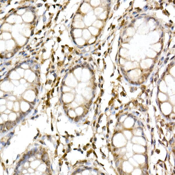 Immunohistochemistry: Cullin 1 Antibody - Azide and BSA Free [NBP3-16092] - Immunohistochemistry analysis of paraffin-embedded Human colon using Cullin 1 Rabbit pAb at dilution of 1:50 (40x lens). High pressure antigen retrieval performed with 0.01M Citrate Bufferr (pH 6.0) prior to IHC staining.