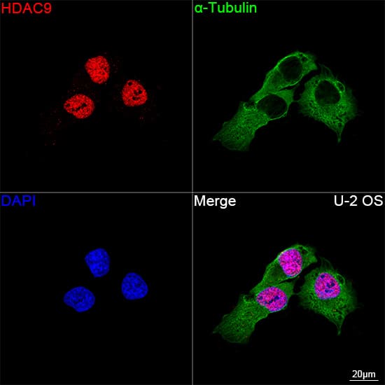 Immunocytochemistry/ Immunofluorescence: HDAC9 Antibody (3L5E5) [NBP3-16097] - Confocal imaging of U-2 OS cells using HDAC9 Rabbit mAb followed by a further incubation with Cy3 Goat Anti-Rabbit IgG (H+L) . The cells were counterstained with alpha-Tubulin Mouse mAb followed by incubation with ABflo(R) 488-conjugated Goat Anti-Mouse IgG (H+L) Ab (Green). DAPI was used for nuclear staining (Blue). Objective: 100x.