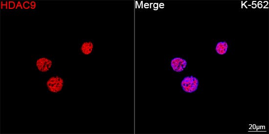 Immunocytochemistry/ Immunofluorescence: HDAC9 Antibody (3L5E5) [NBP3-16097] - Confocal imaging of K-562 cells using HDAC9 Rabbit mAb followed by a further incubation with Cy3 Goat Anti-Rabbit IgG (H+L) . DAPI was used for nuclear staining (Blue). Objective: 100x.